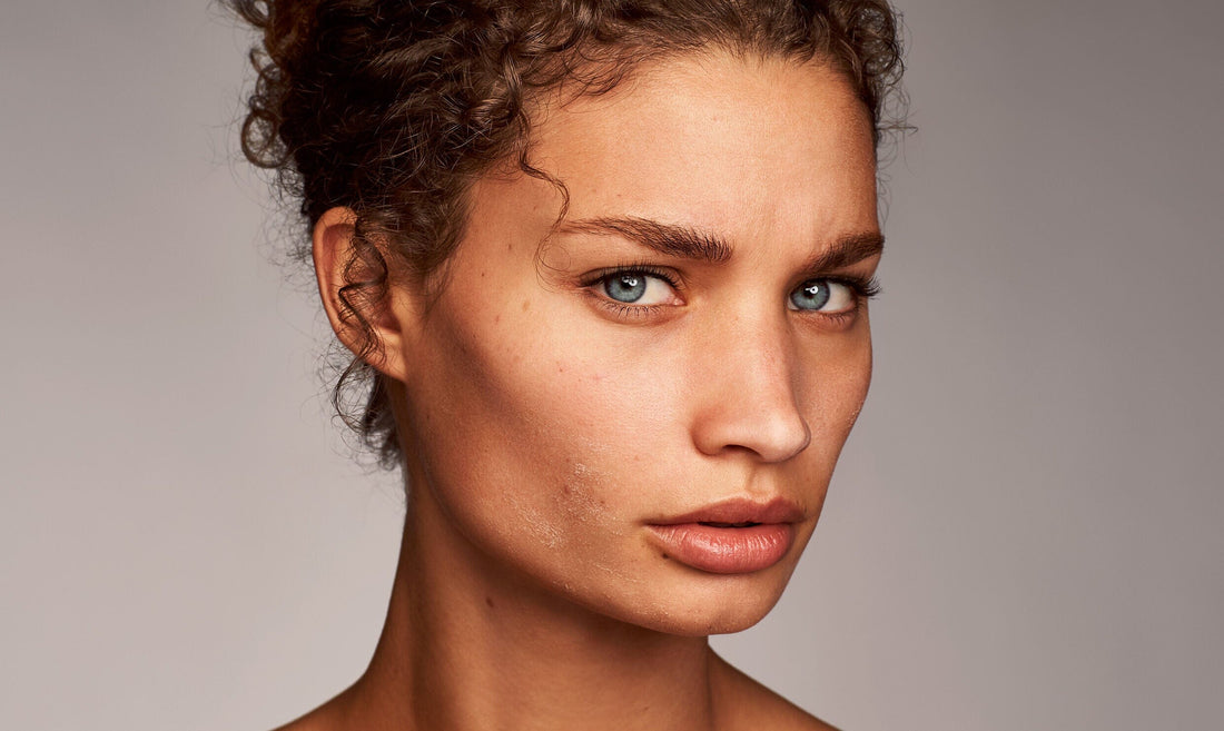 9 Ways on How To Repair Dry Skin