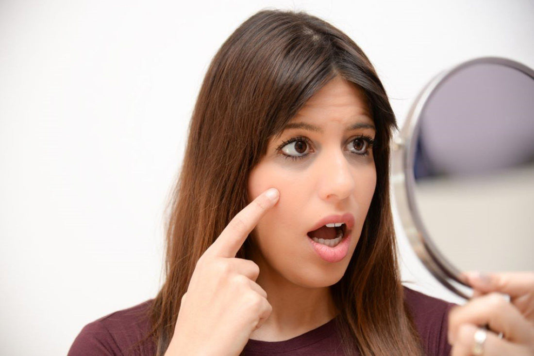 Everything You NEED to Know About EYE Cream and Dark Circle Reduction