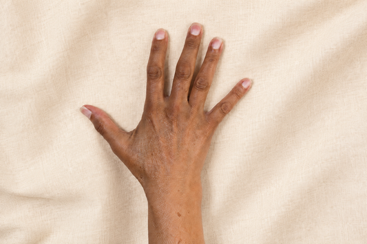 AHA for Dark Knuckles - What Works and What Does Not